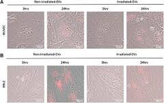 Mesenchymal stem cell-derived extracellular vesicles as probable ...