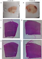 Cell type-specific gene expression dynamics during human brain ...