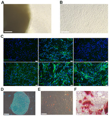 Human umbilical cord mesenchymal stem cells-derived exosomes exert ...